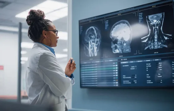 a nurse looking at brain scan images on monitor